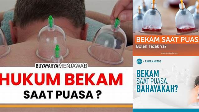 Bekam Saat Puasa