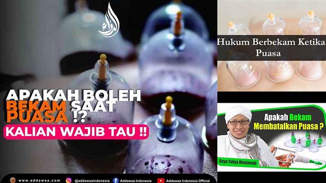 Bekam Saat Puasa Hukumnya